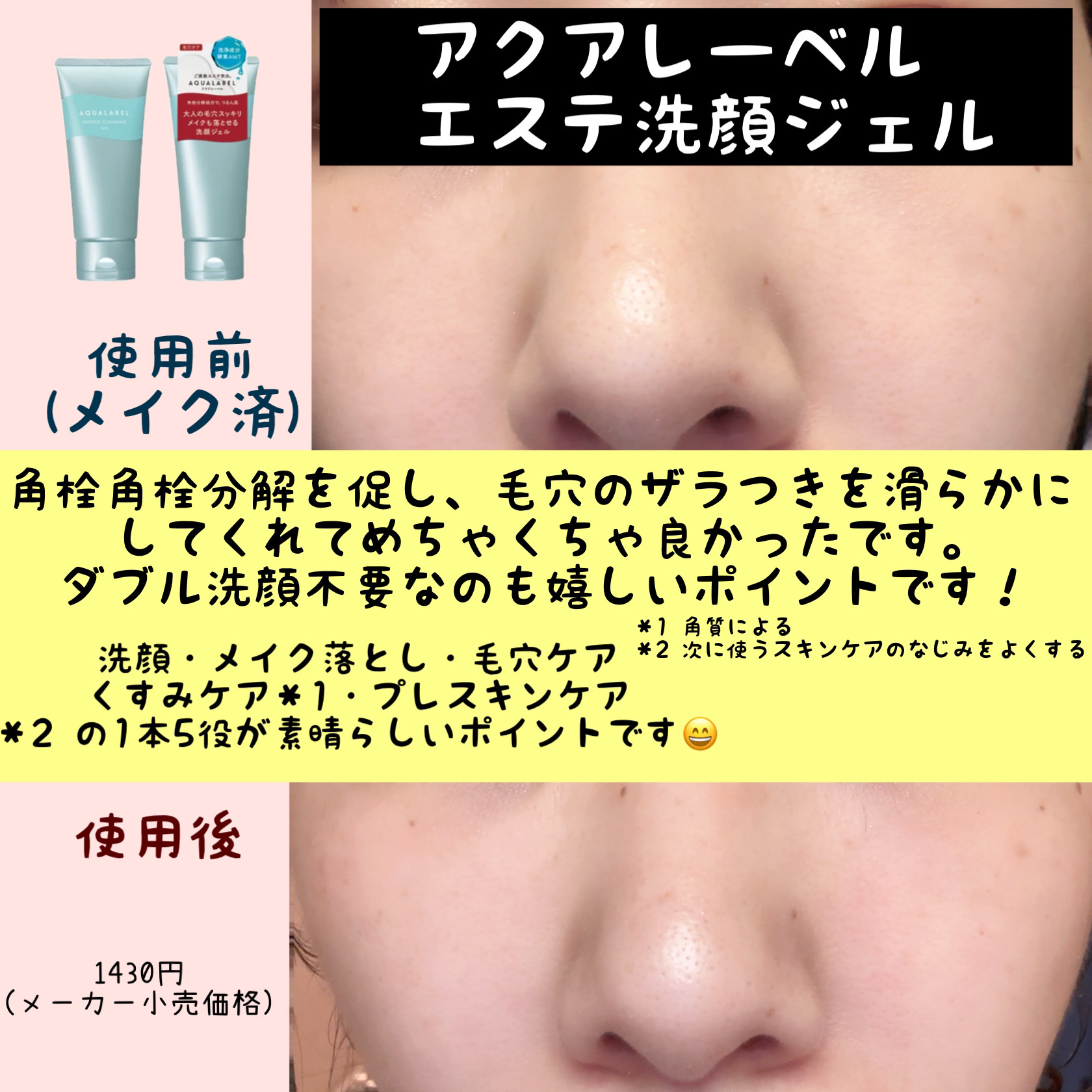 エステ洗顔ジェル/アクアレーベル/その他洗顔料を使ったクチコミ（2枚目）