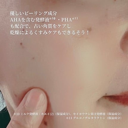 パーフェクトワン 薬用ホワイトニングジェル/パーフェクトワン/オールインワン化粧品を使ったクチコミ(6枚目)