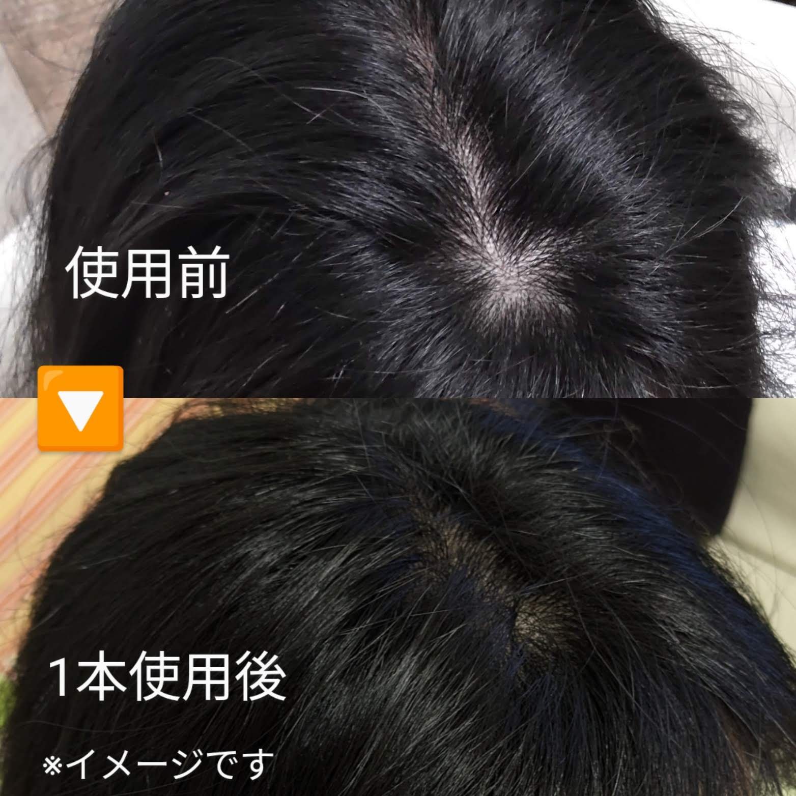 ラシクスｒDDSスカルプエッセンス/RASIX/頭皮ローションを使ったクチコミ（1枚目）