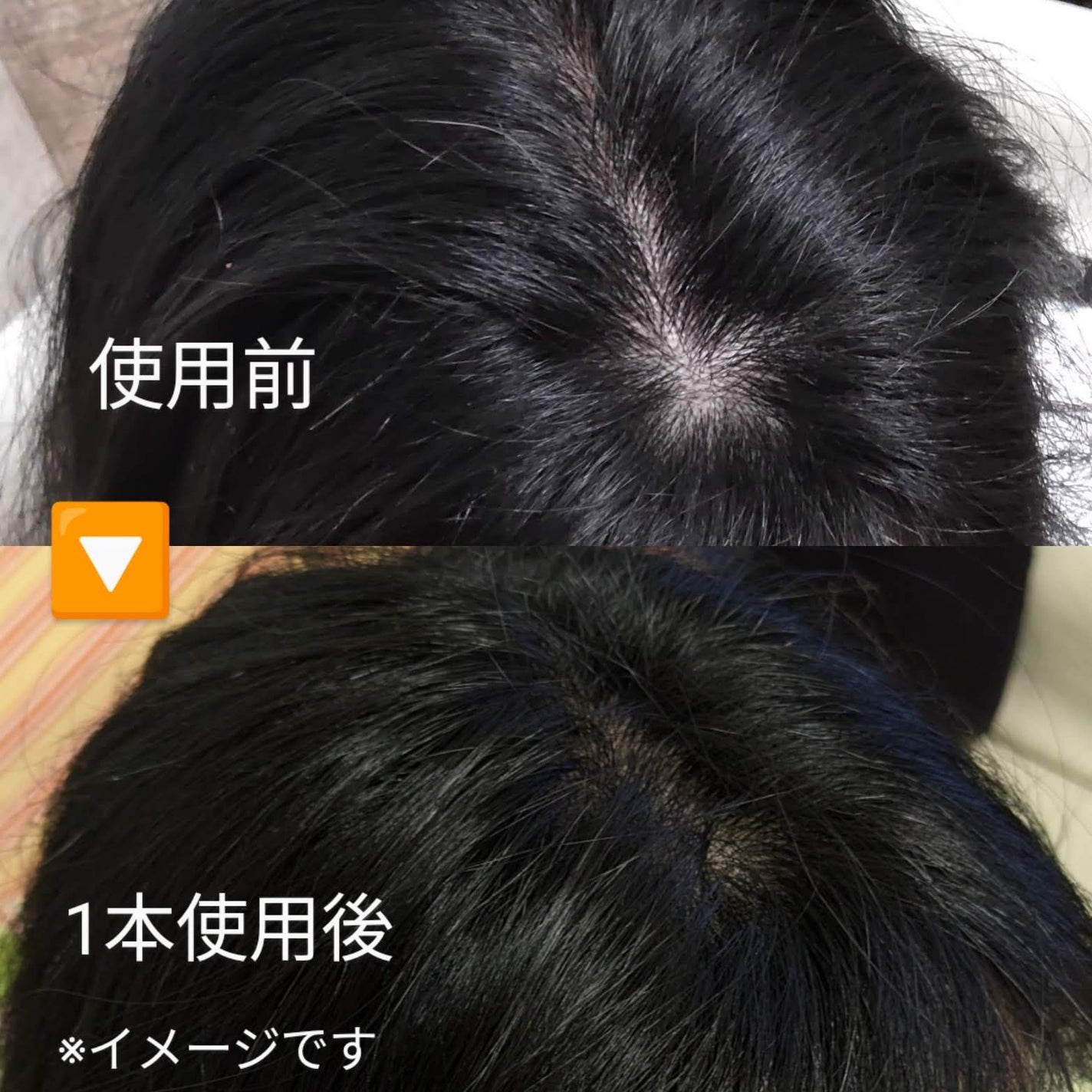 ラシクスrDDSスカルプエッセンス/RASIX/頭皮ローションを使ったクチコミ(1枚目)