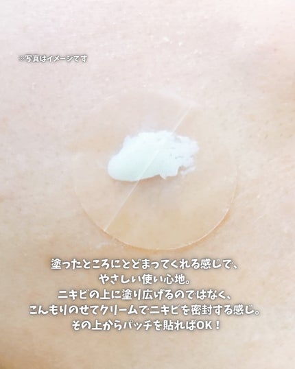 アクネスラボ 相澤メソッド 薬用ミドリクリーム/HIN アクネスラボ/フェイスクリームを使ったクチコミ(7枚目)