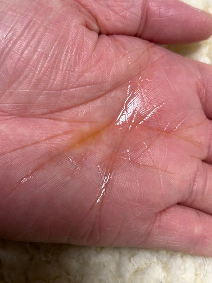 ヘアリッチローション/リソウコーポレーション/頭皮ローションを使ったクチコミ(2枚目)