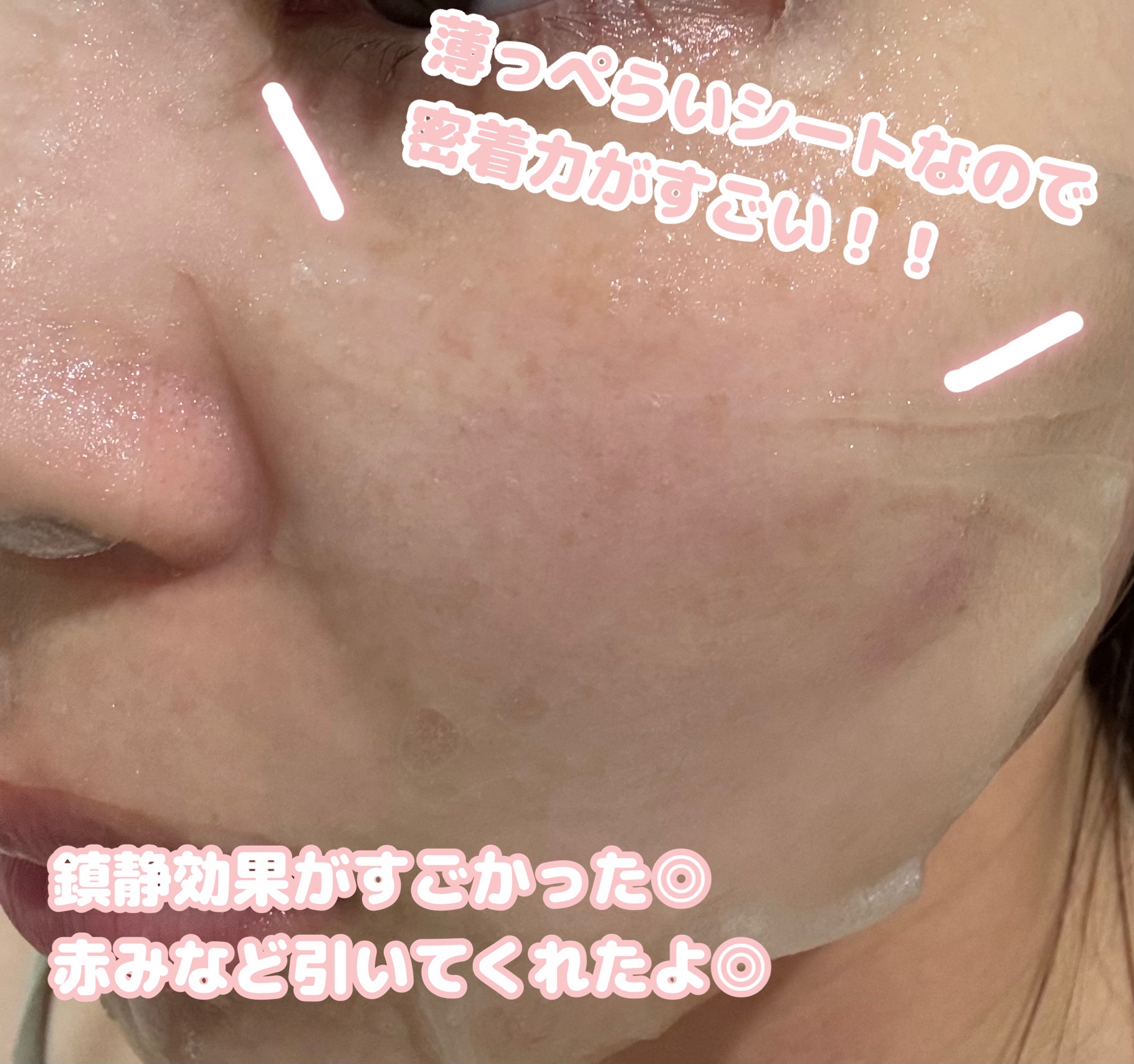 シカペア インテンシブ S リペア セラム マスク/Dr.Jart＋/シートマスク・パックを使ったクチコミ（3枚目）