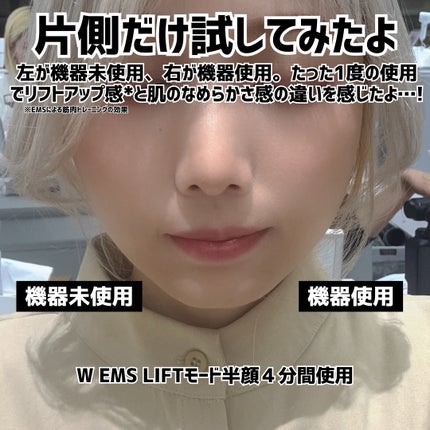 バイタリフト かっさ EH-SP86/Panasonic/美顔器・マッサージを使ったクチコミ(5枚目)