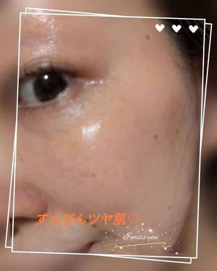 C+クリアセラム/ヴィオテラス/美容液を使ったクチコミ(7枚目)