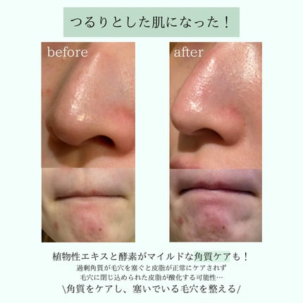 ディープクリーンマスター/ilso/その他スキンケアグッズを使ったクチコミ(4枚目)