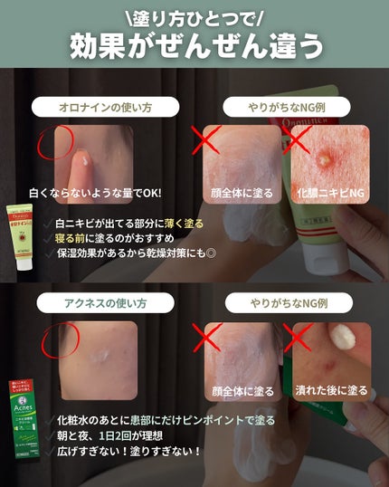 白湯(サユ) | ニキビと戦うOL🤍 on LIPS 「白湯です!実はこの企画ずっとやりたかった!!!!私は断然アクネ..」(6枚目)