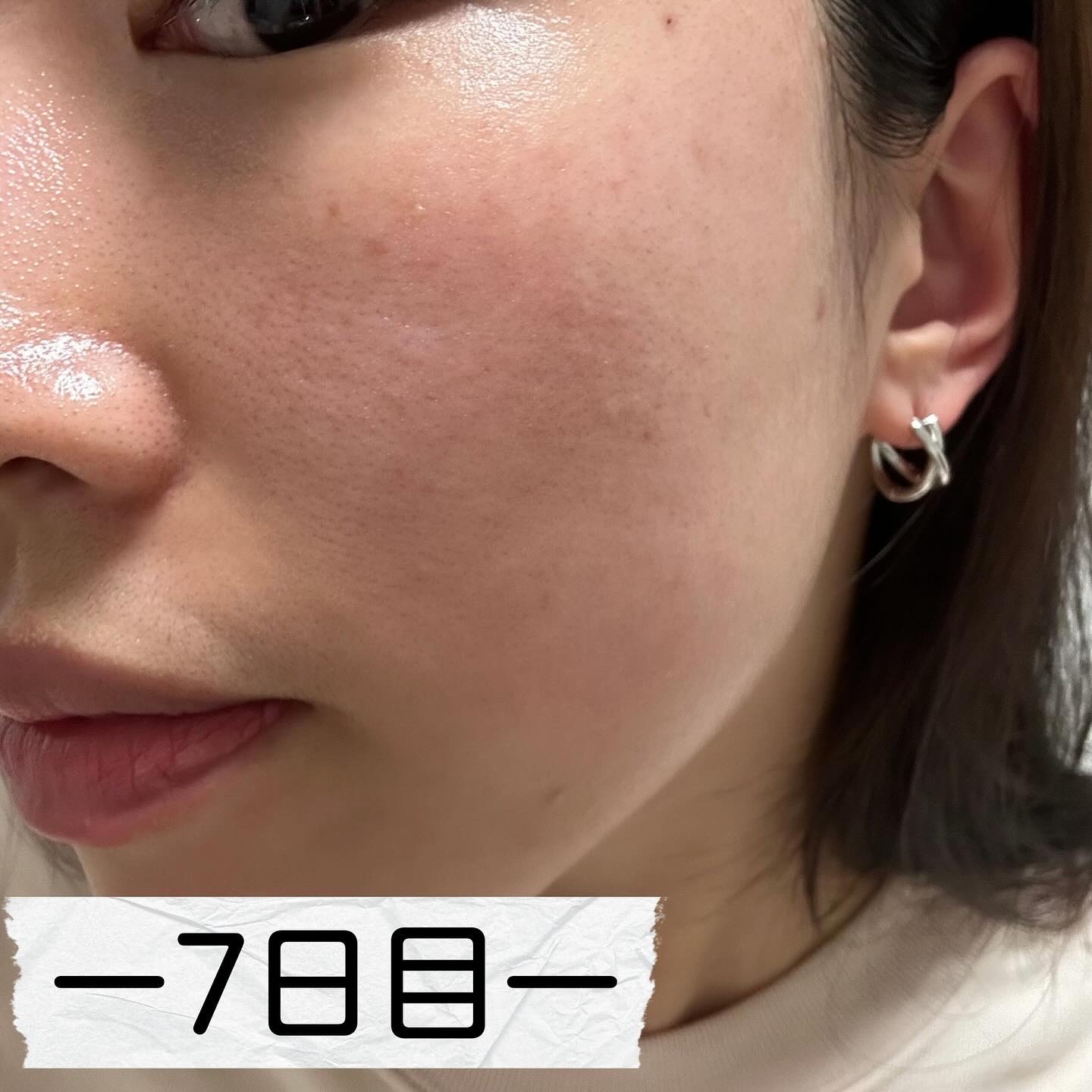 PDRN+ デイリーマスク/VT/シートマスク・パックを使ったクチコミ（3枚目）