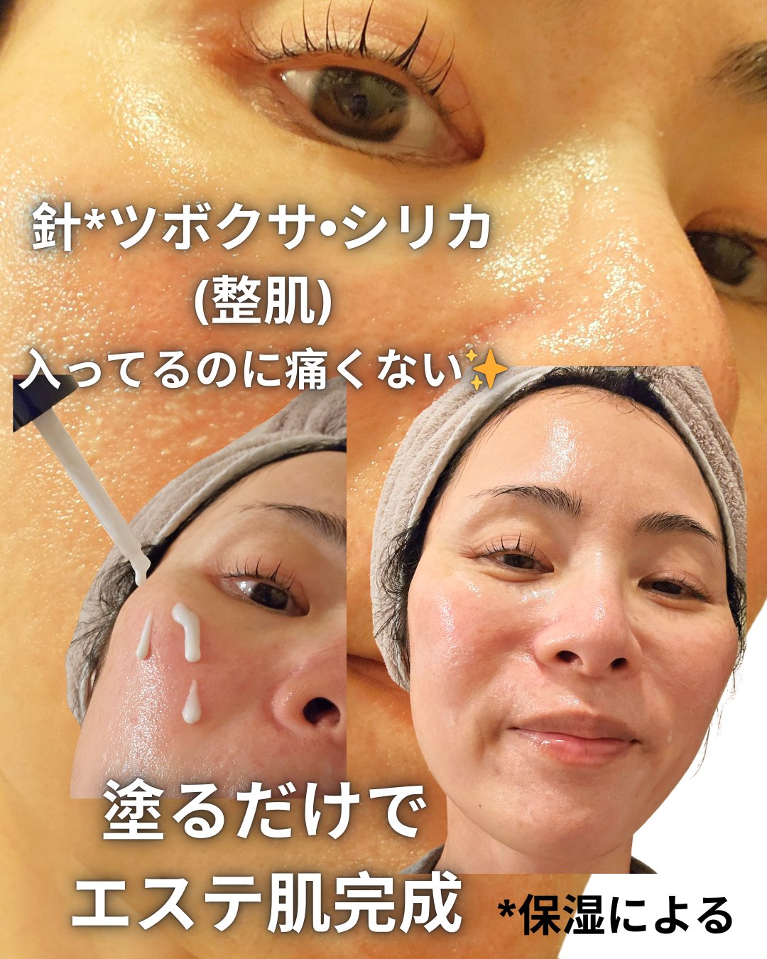 リードルS PDRN+ セラム/VT/美容液を使ったクチコミ（3枚目）