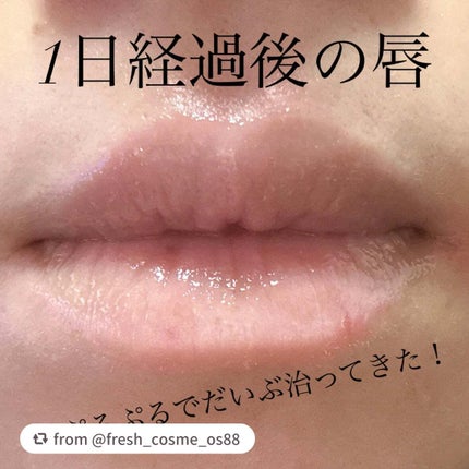 レチノール ボリューム リップセラム/primera/リップグロスを使ったクチコミ(4枚目)