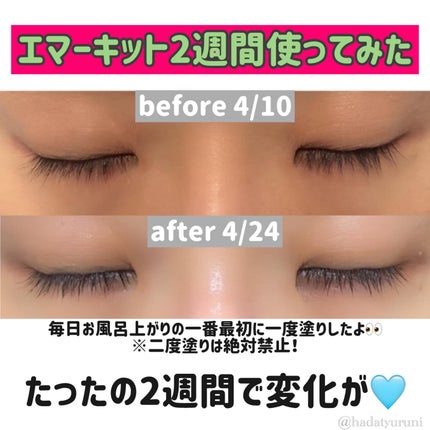 EMAKED(エマーキット)/水橋保寿堂製薬/まつげ美容液を使ったクチコミ(1枚目)