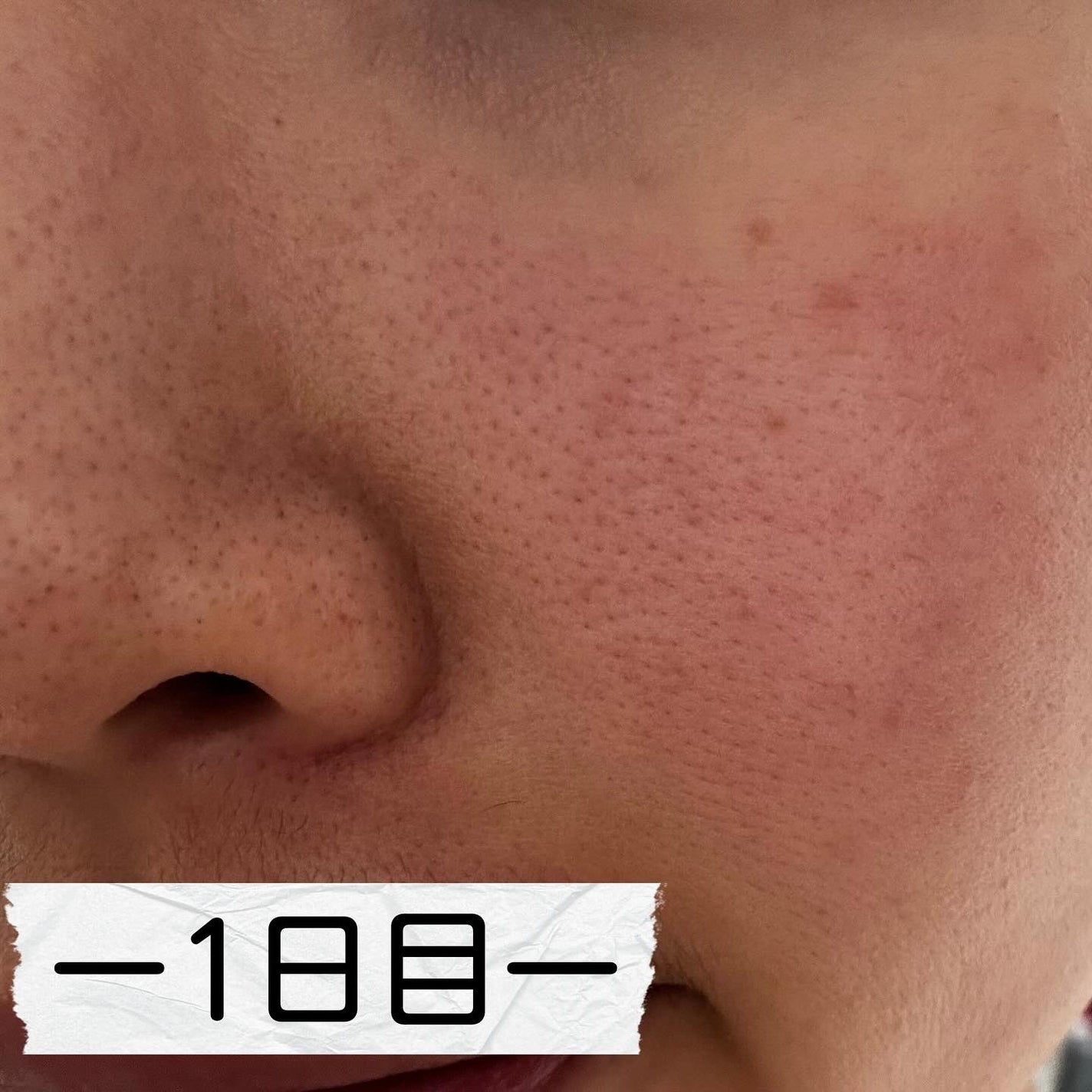 PDRN+ デイリーマスク/VT/シートマスク・パックを使ったクチコミ(2枚目)