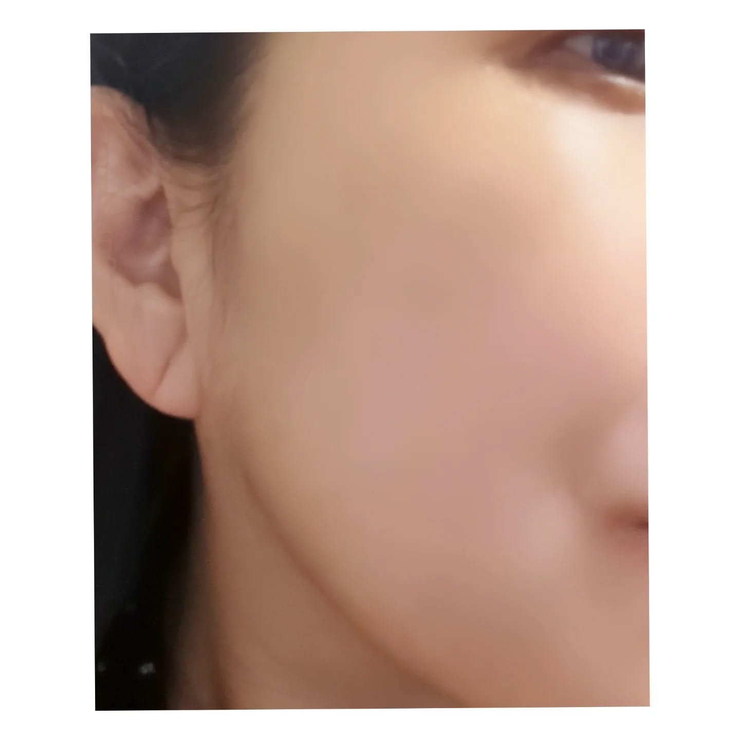 プロバイオシカ インテンシブ アンプル/SKIN1004/美容液を使ったクチコミ（3枚目）