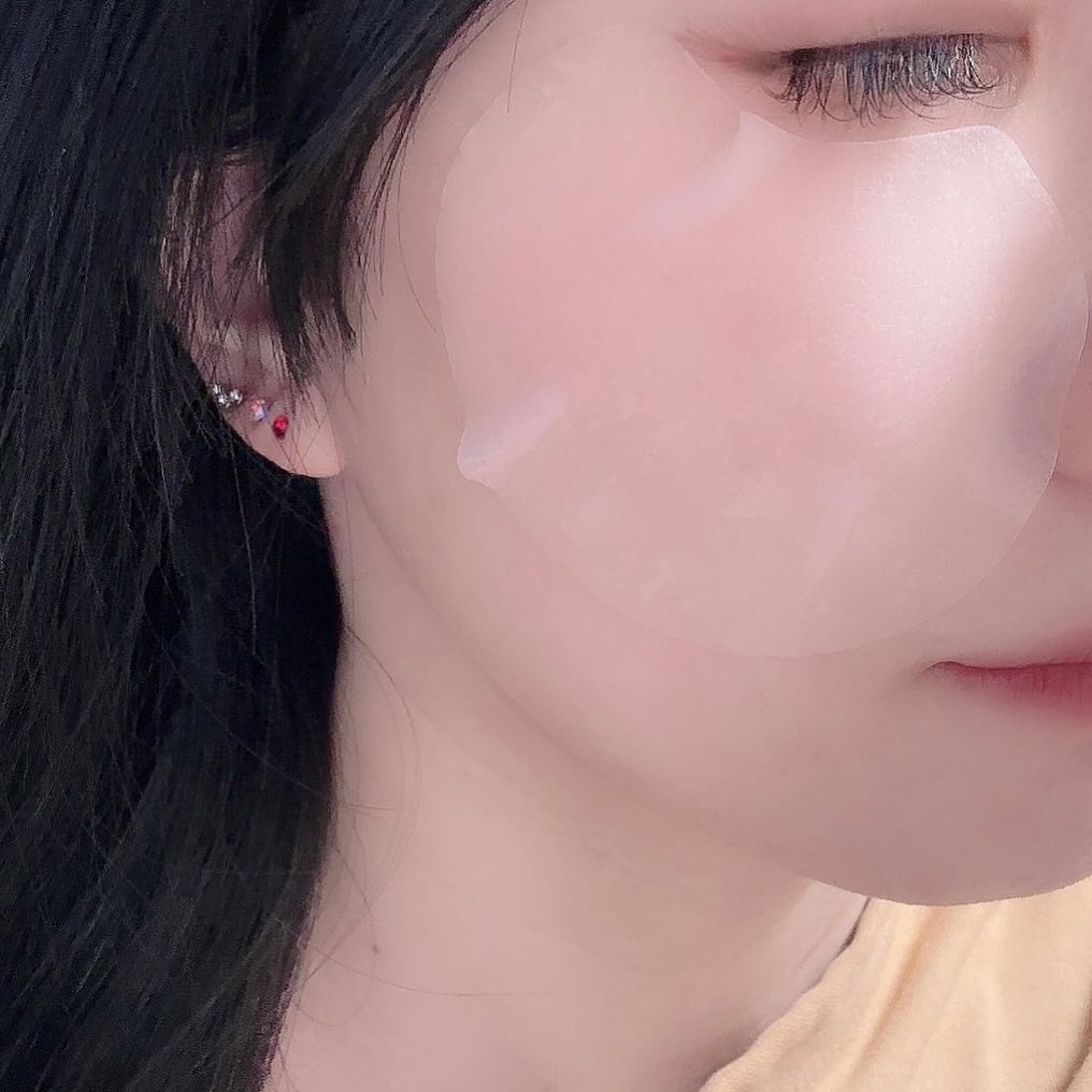 センテラ クイックカーミングパッド/SKIN1004/トナーパッドを使ったクチコミ(5枚目)