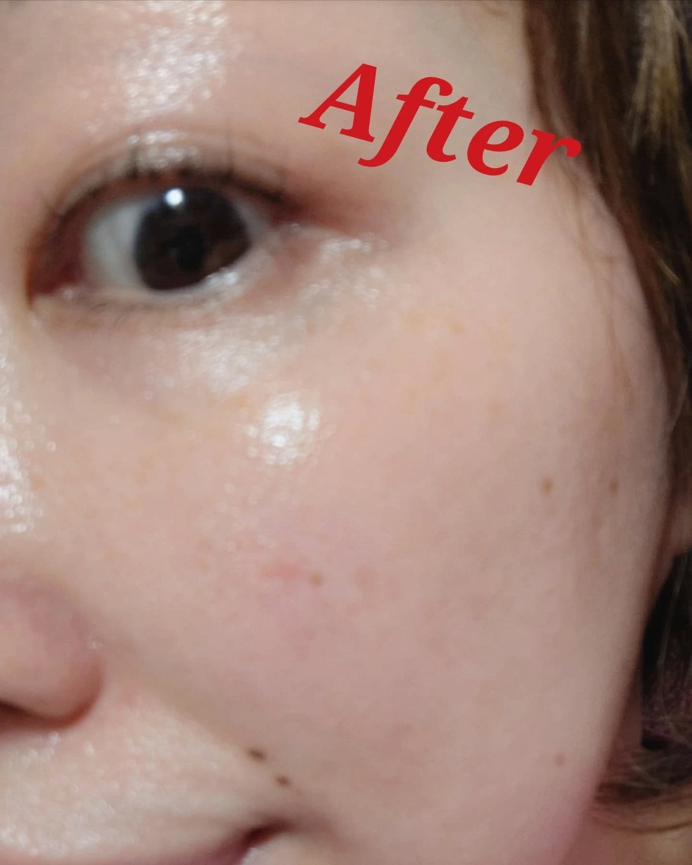 C+クリアセラム/ヴィオテラス/美容液を使ったクチコミ(9枚目)