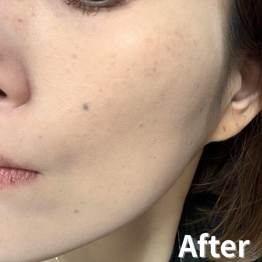 ソフトマットプレストパウダー/FUNNY ELVES方里/プレストパウダーを使ったクチコミ(7枚目)