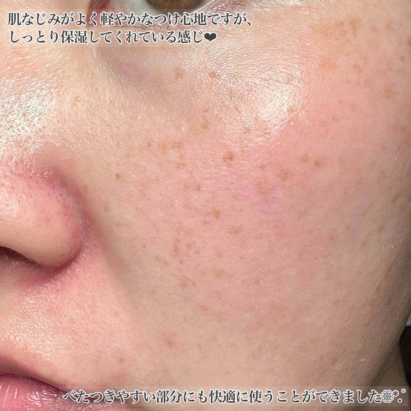 Pore Perfecting Serum/BeginS by JUNGSAEMMOOL/美容液を使ったクチコミ(4枚目)