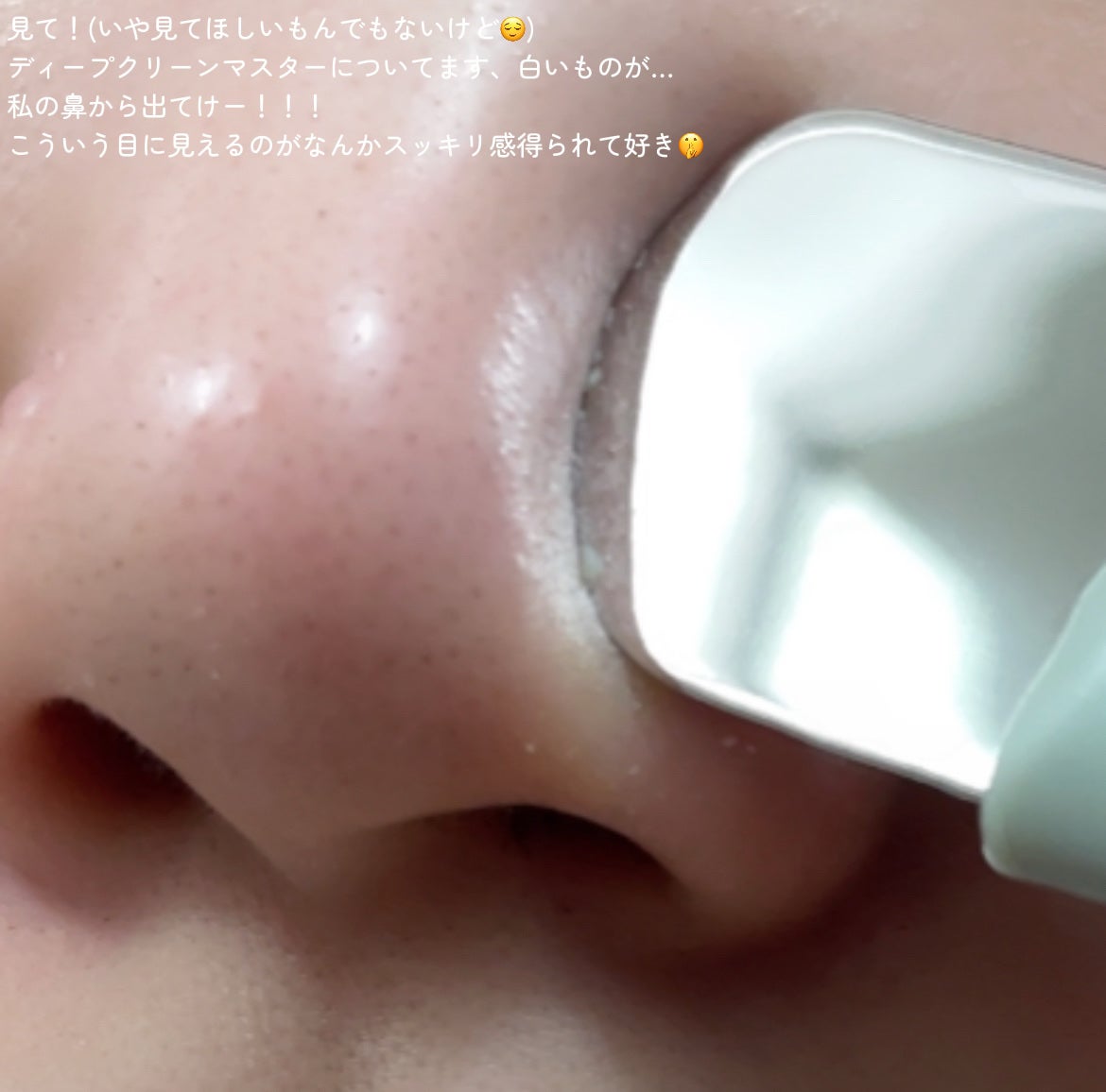 ナチュラルマイルドクリアノーズパック/ilso/シートマスク・パックを使ったクチコミ(4枚目)