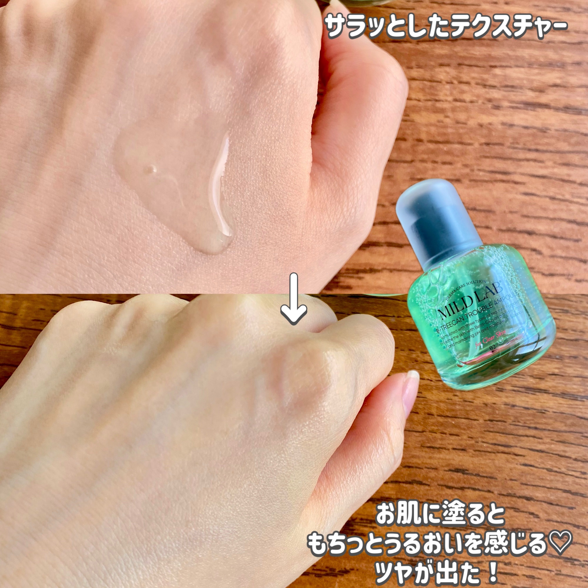 ベターツリカン肌荒れ美容液/Mildlab/美容液を使ったクチコミ（3枚目）