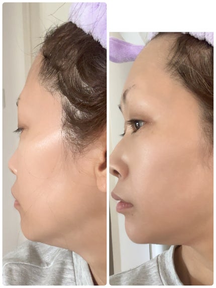 パーフェクトVリフティングプレミアムプラスマスク/avajar/シートマスク・パックを使ったクチコミ(7枚目)