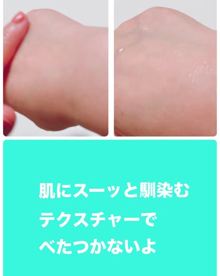 ブレミッシュケアアップ セラム/ISOI/美容液を使ったクチコミ(5枚目)