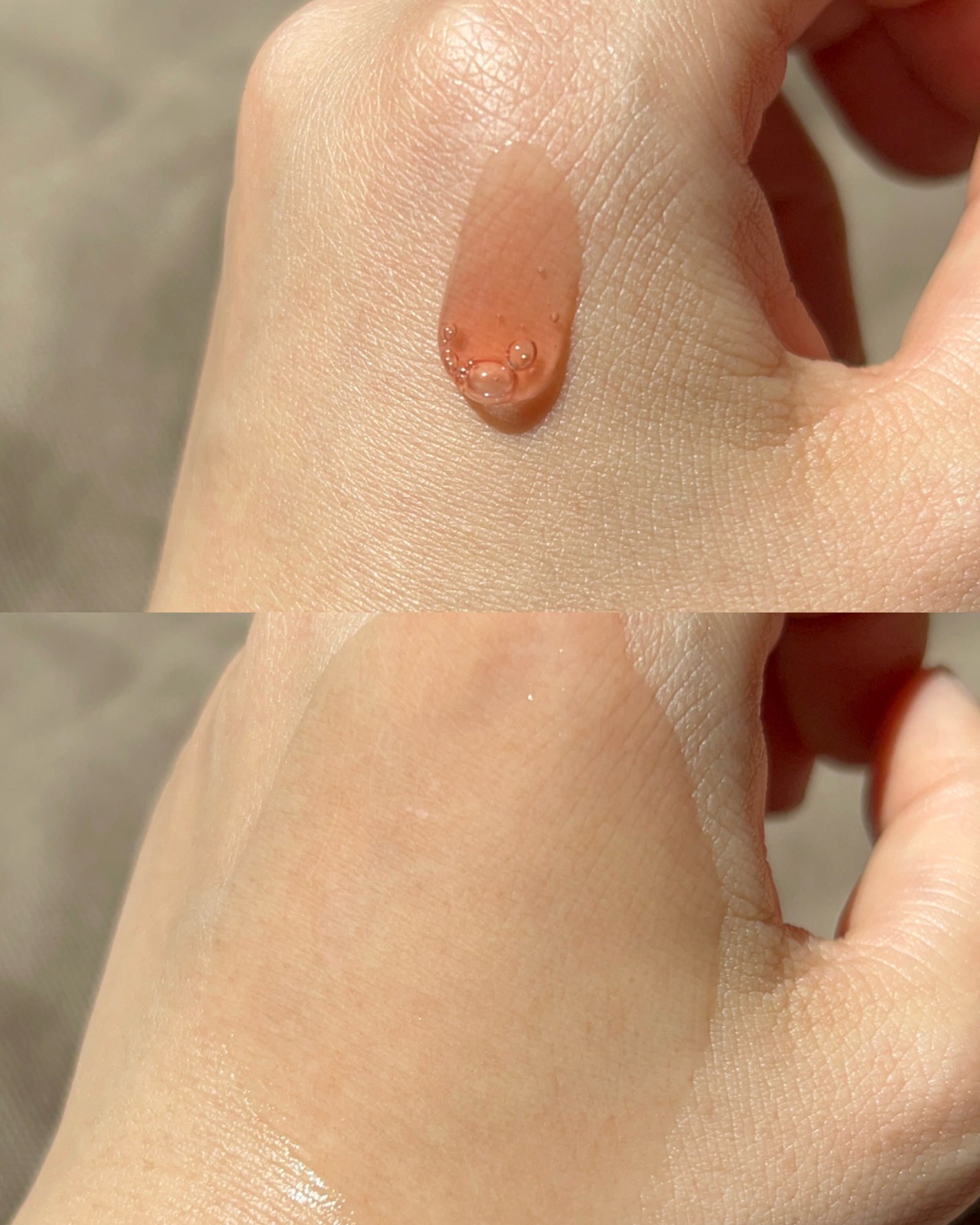 Dr.ROSA IV アンプル3種セット/Dr.ROSA/スキンケアキットを使ったクチコミ(4枚目)