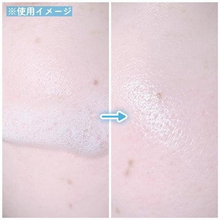 30秒クイックバブルマスク1+1セット/MENOKIN/シートマスク・パックを使ったクチコミ(4枚目)