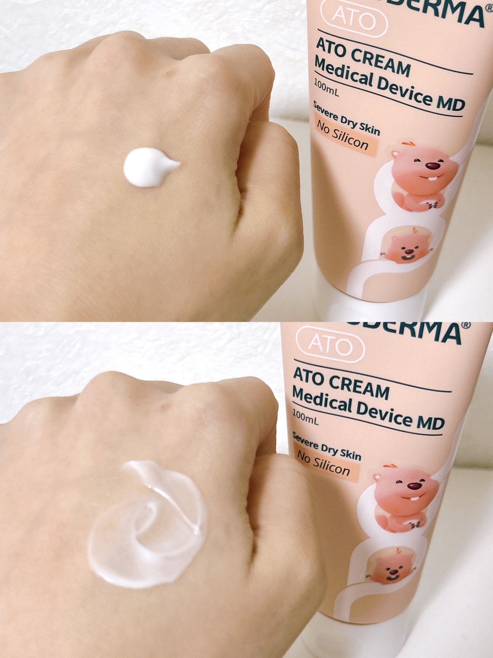 ATO CREAM MD ｜REJUDERMAの効果に関する口コミ - 韓国で圧倒的に人気