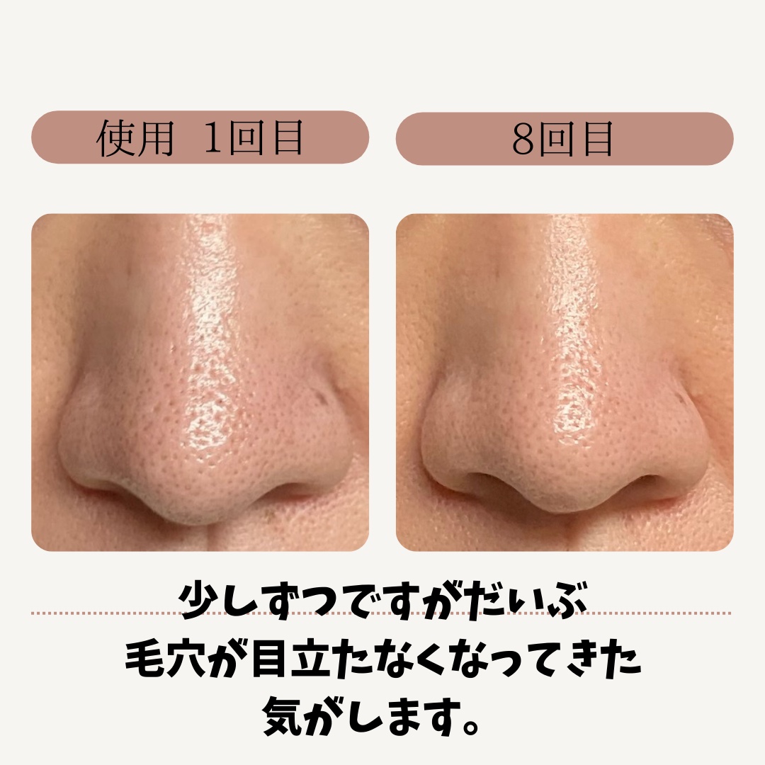 AQ 毛穴美容液オイル/DECORTÉ/フェイスオイルを使ったクチコミ（2枚目）