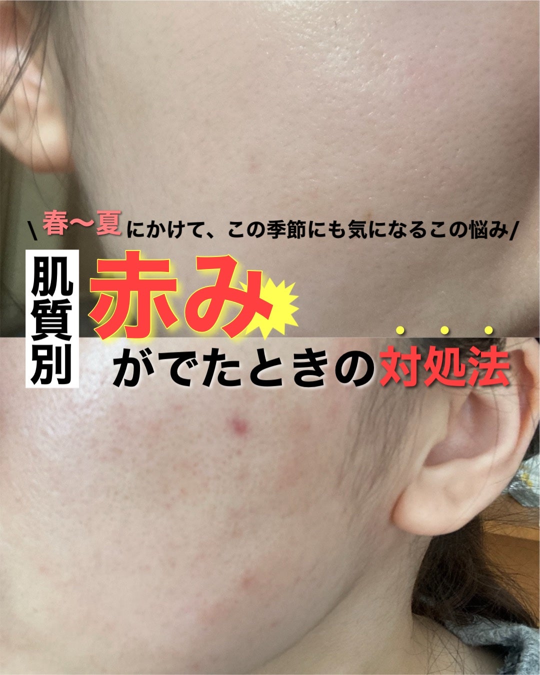 ジェントル クレンジングミルク/アベンヌ/ミルククレンジングを使ったクチコミ(1枚目)