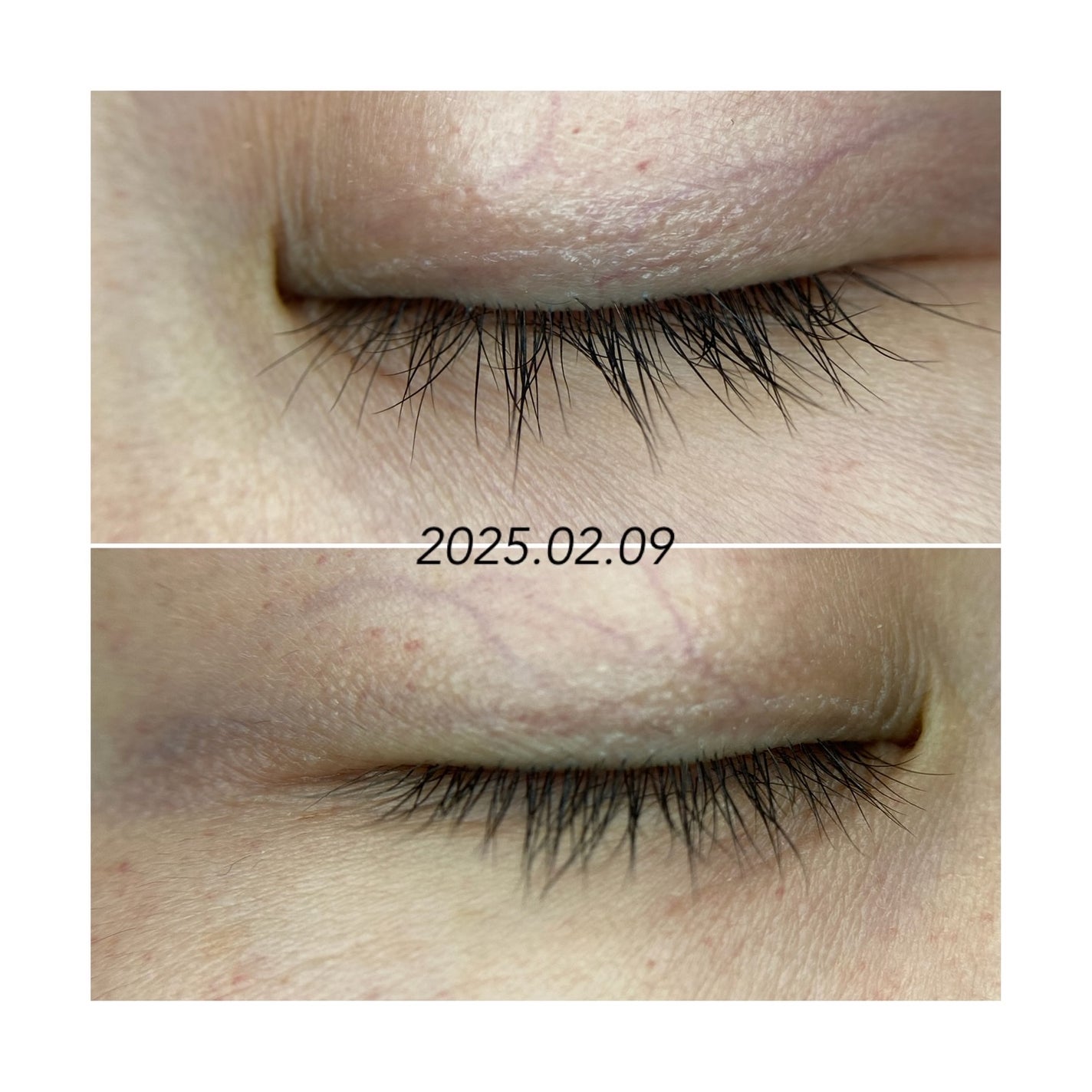 Lash drip アイラッシュセラム/Lash drip/まつげ美容液を使ったクチコミ(5枚目)