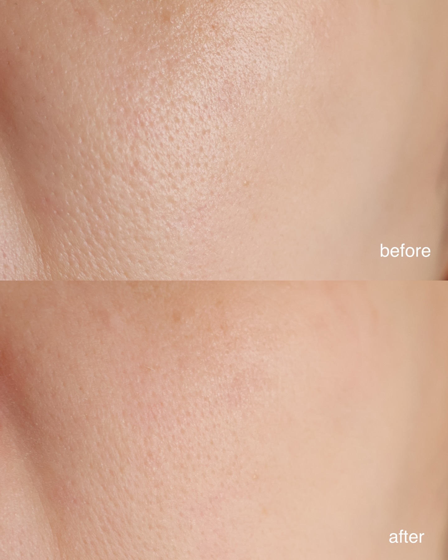 オレンジスキンデリート/BONAMEDUSA/化粧下地を使ったクチコミ（3枚目）