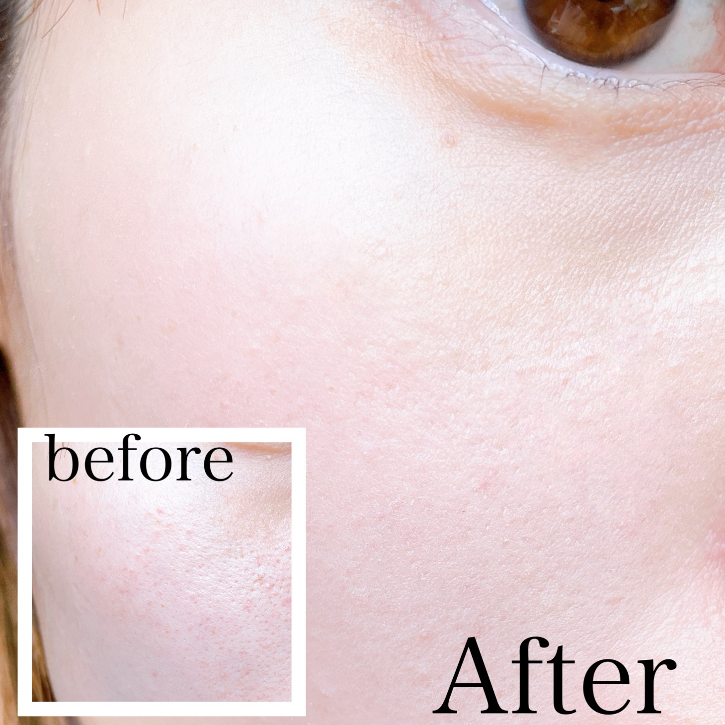 ヴェルヴェットラスティングパクト/AGE20’s/その他ファンデーションを使ったクチコミ（3枚目）