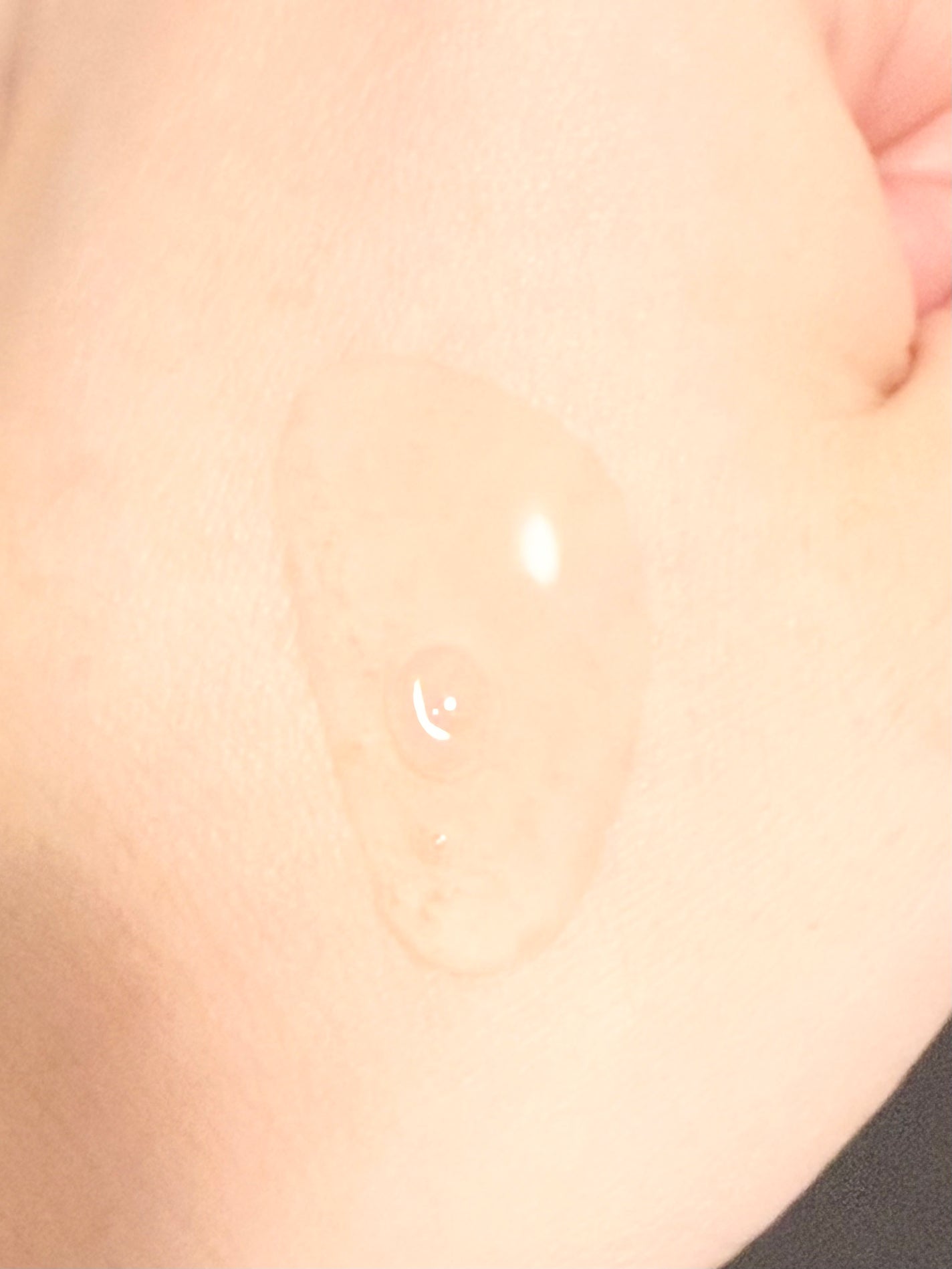 トラネキサム酸10%ブライトニングセラム/Real Barrier/美容液を使ったクチコミ(2枚目)