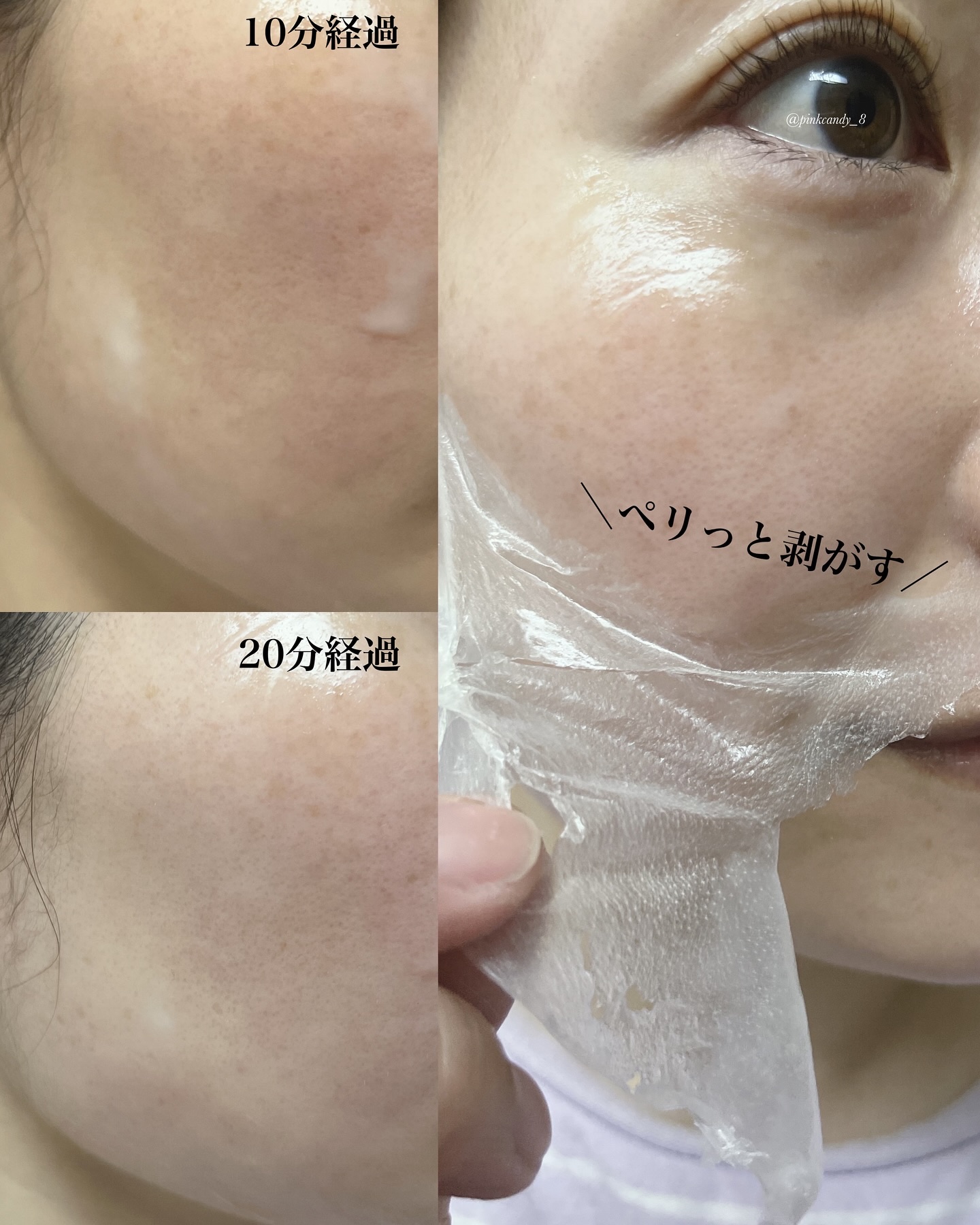 アンチリンクルエフェクトアンプルオリジン/MIGUHARA/美容液を使ったクチコミ（3枚目）