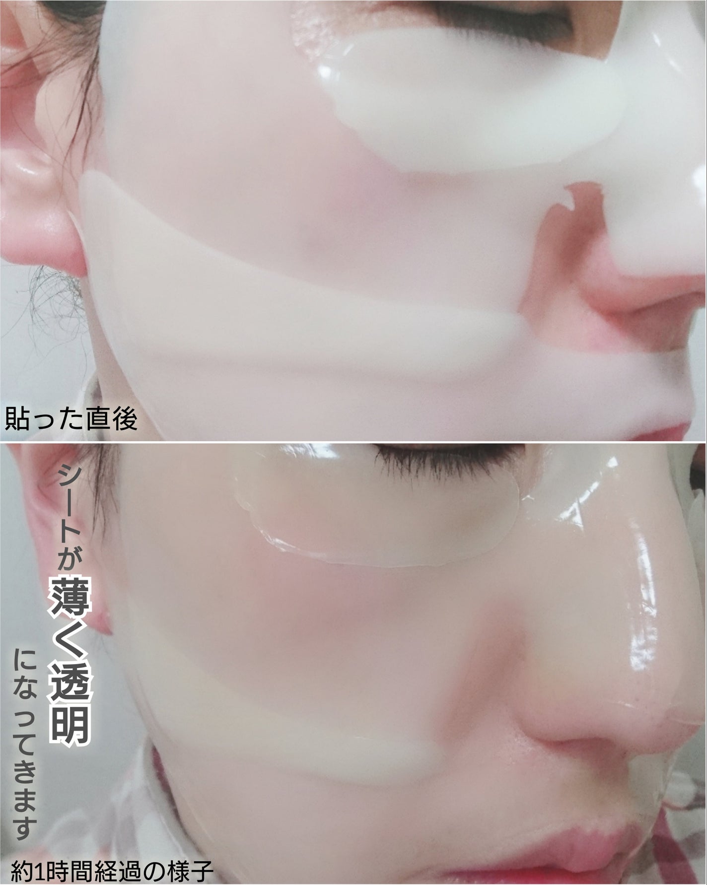 レチA リードルショット100 2ステップハイドロゲルマスク/VT/シートマスク・パックを使ったクチコミ(5枚目)