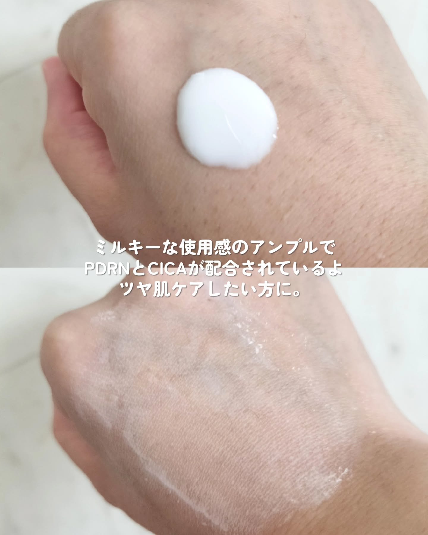 リードルショット300/VT/美容液を使ったクチコミ（3枚目）