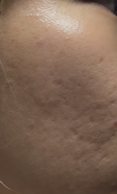 UVイデア XL プロテクショントーンアップ ローズ+/ラ ロッシュ ポゼ/日焼け止め・UVケアを使ったクチコミ（2枚目）