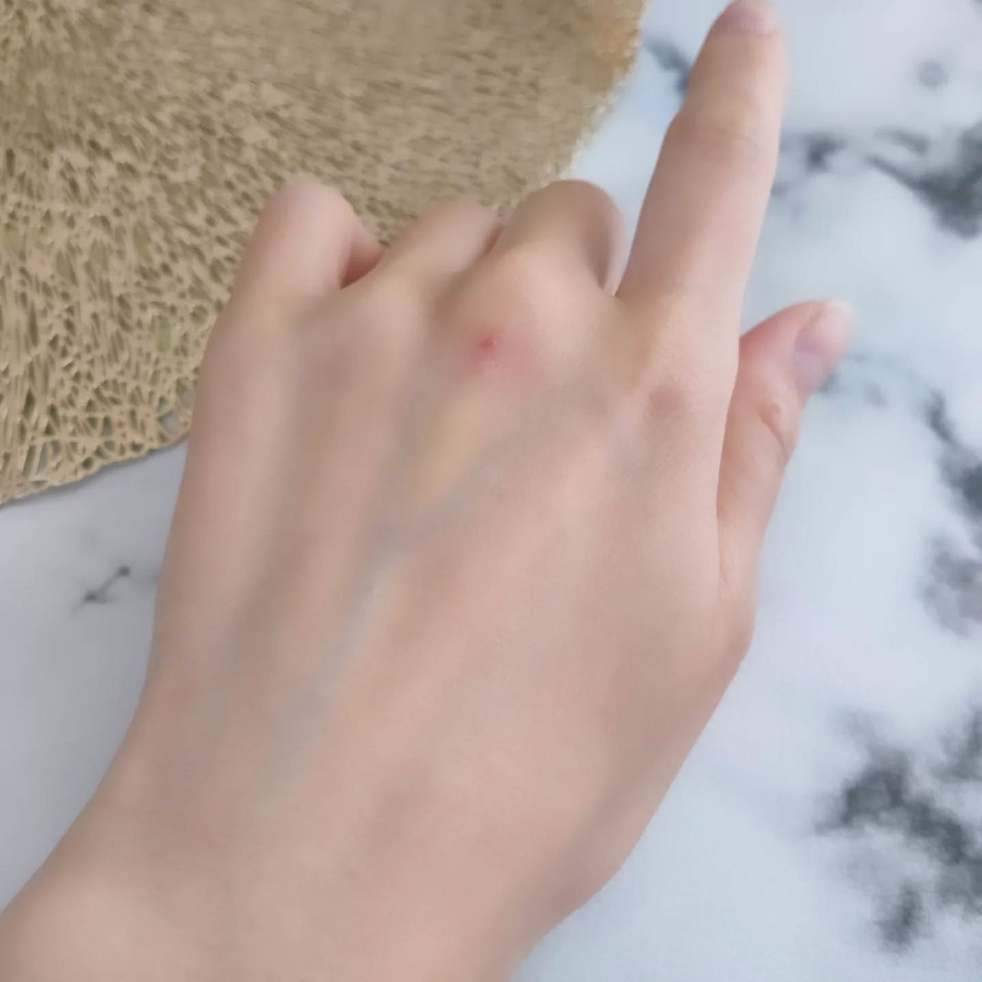 レッドブレミッシュ クリアスージングクリーム/Dr.G/フェイスクリームを使ったクチコミ(10枚目)