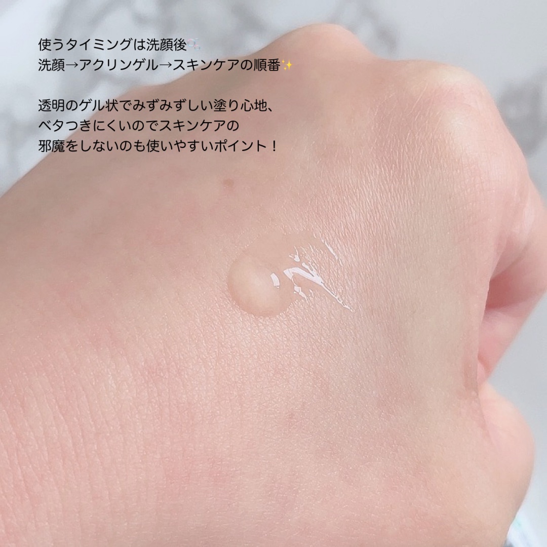 アクリンゲル/東亜製薬/その他スキンケアを使ったクチコミ（3枚目）