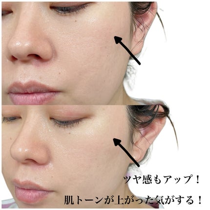 natsumi on LIPS 「毎日3分自宅でポテンツァ/メディテラピー@meditherap..」(4枚目)