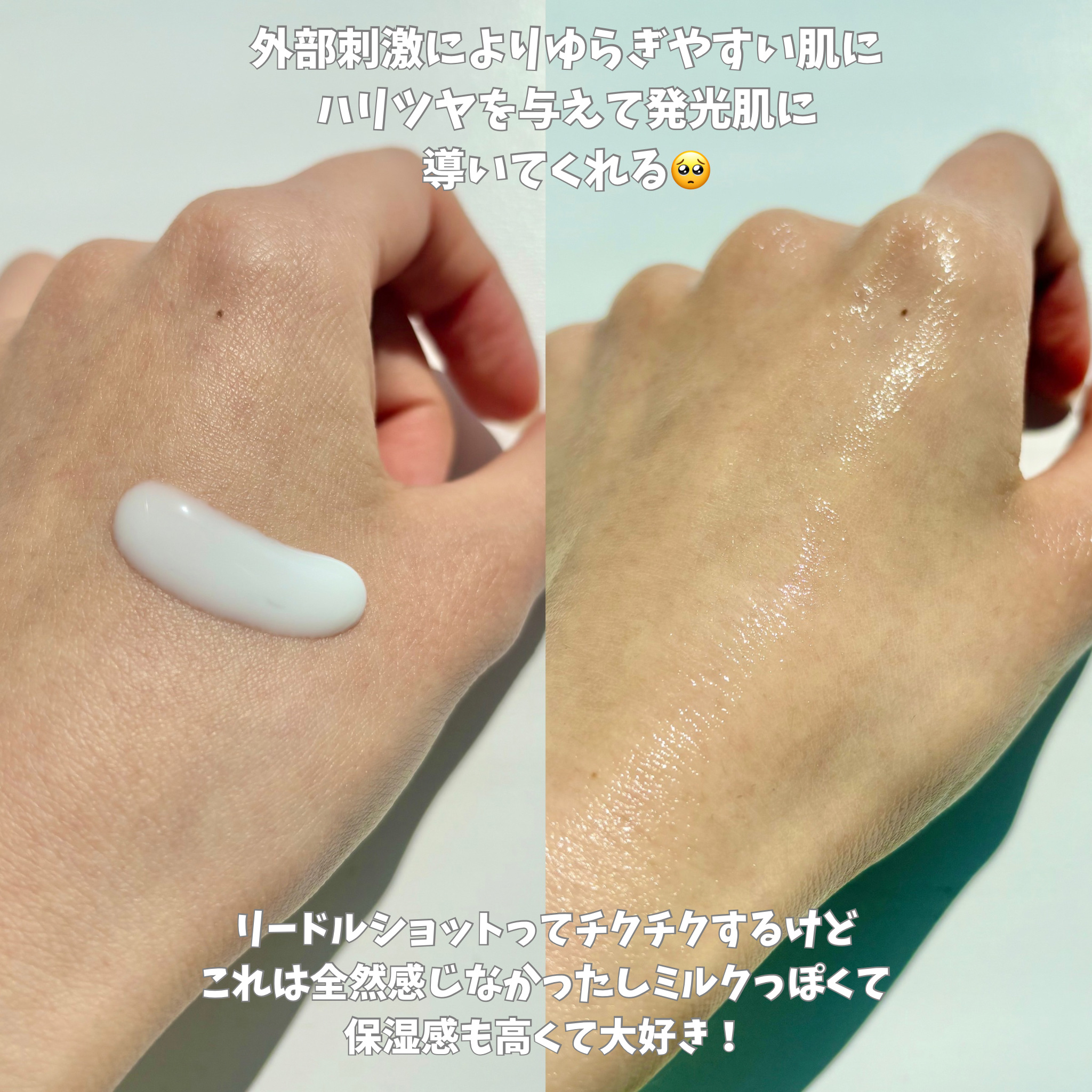 リードルS PDRN+ セラム/VT/美容液を使ったクチコミ（3枚目）