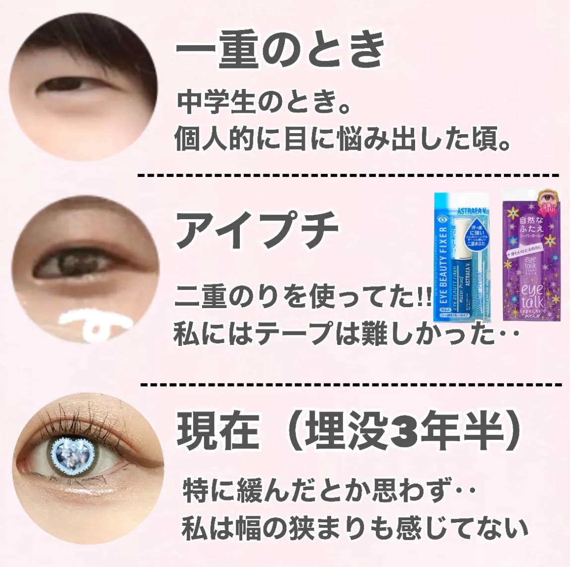 アイビューティー フィクサー WP/アストレア ヴィルゴ/二重まぶた用アイテムを使ったクチコミ（2枚目）