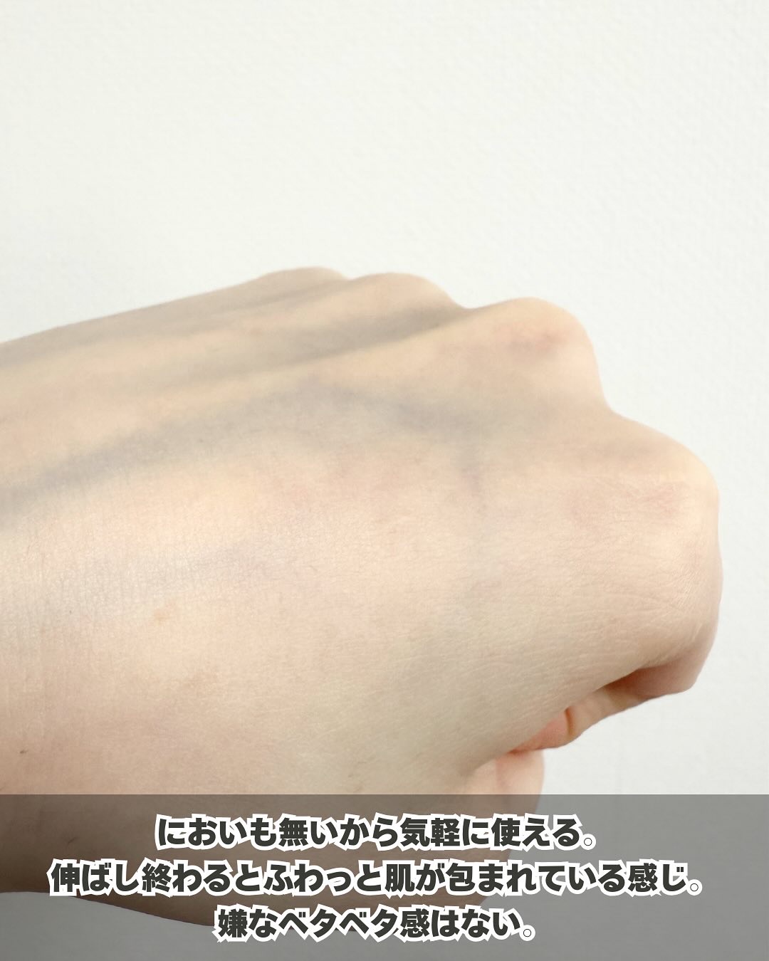 コーワ20％尿素配合クリーム(医薬品)/ケラチナミン/その他 by ぽんず