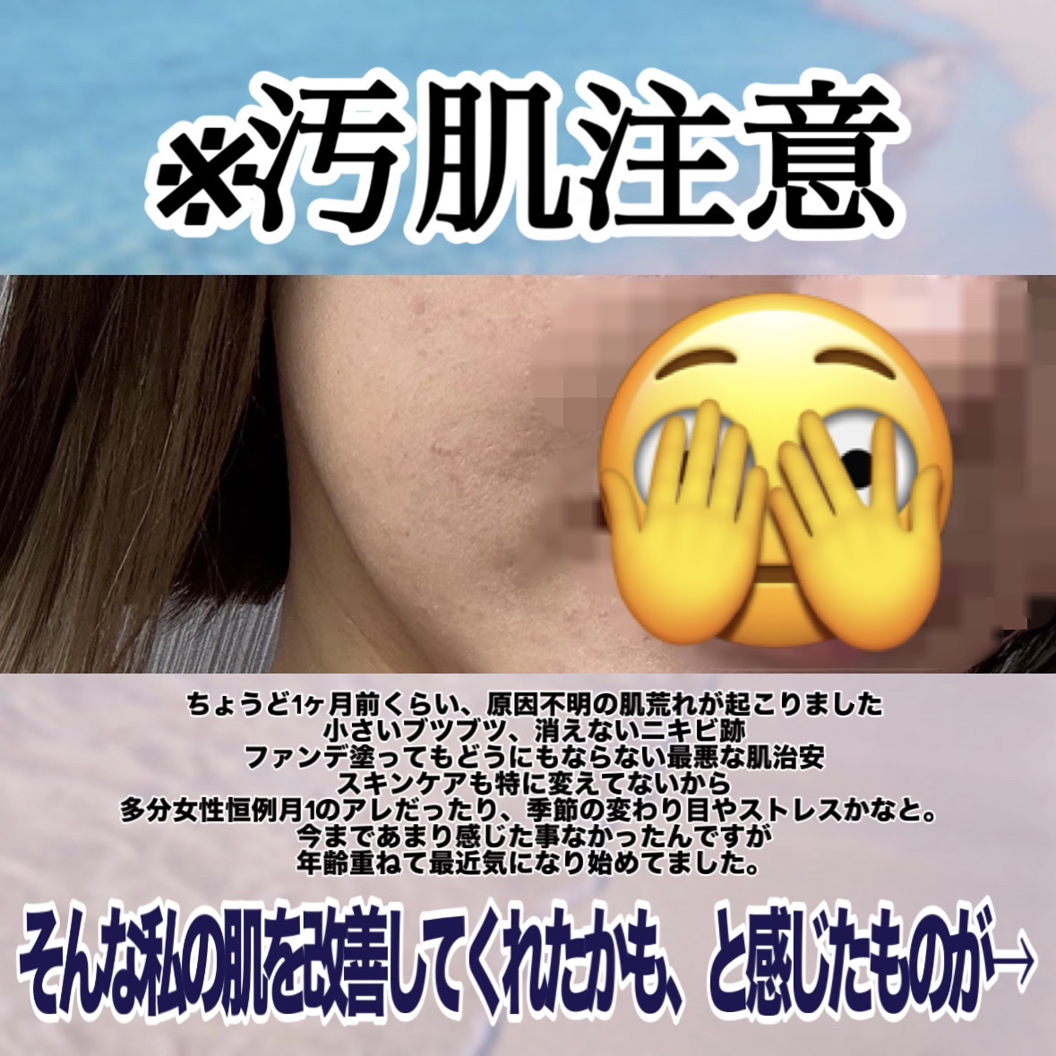 クリアフル ローションM(しっとりタイプ)/オルビス/化粧水を使ったクチコミ（2枚目）