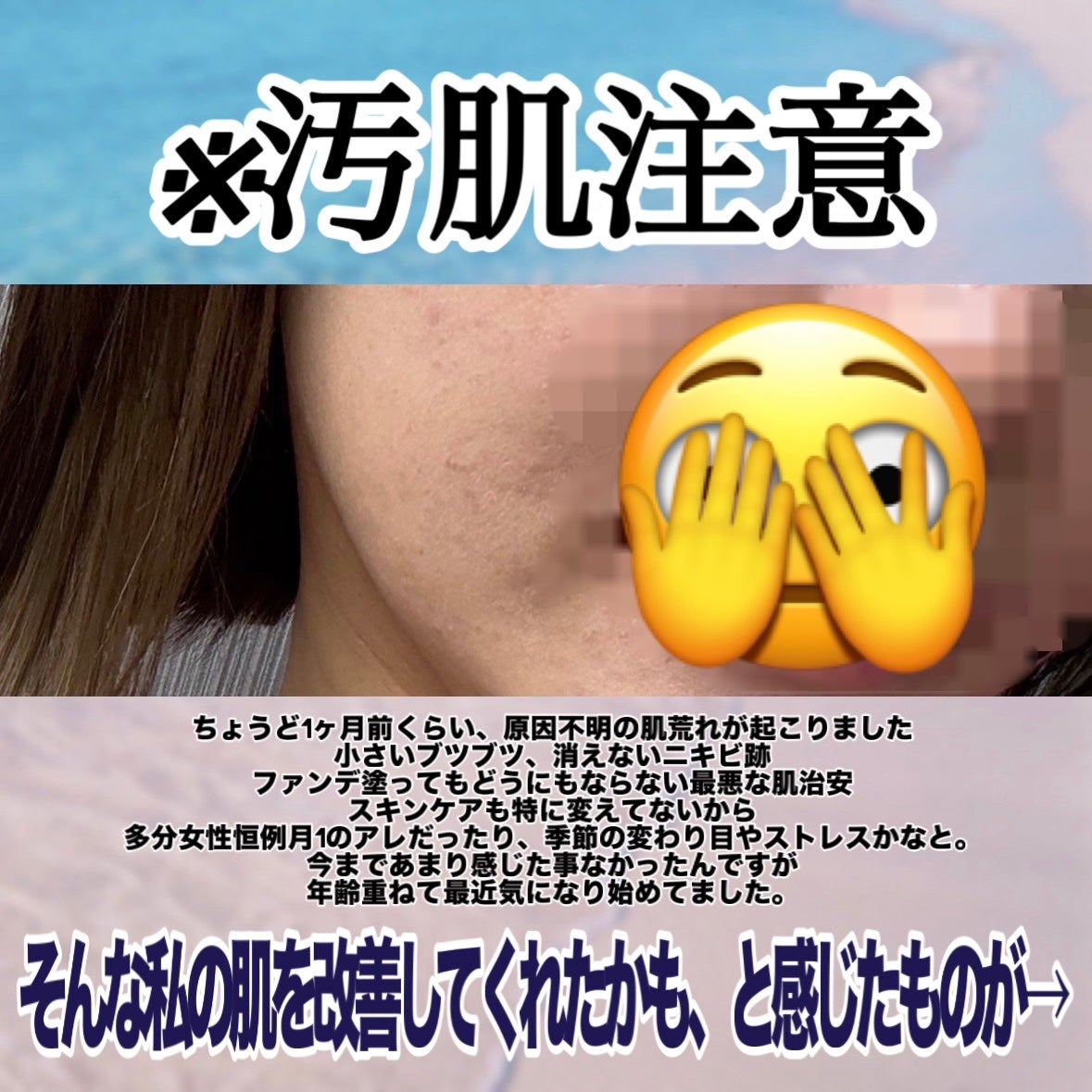 クリアフル ローションM(しっとりタイプ)/オルビス/化粧水を使ったクチコミ(2枚目)