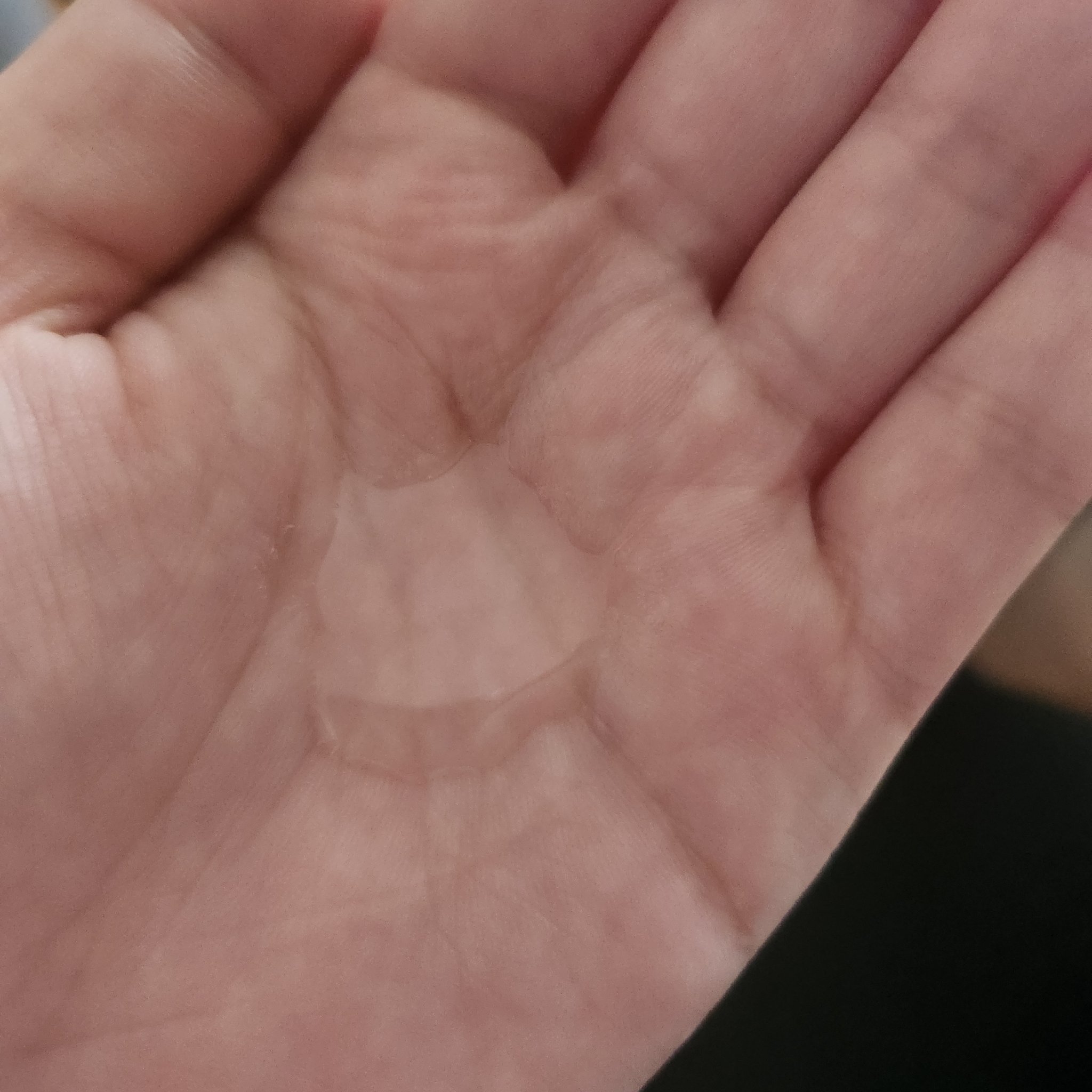 生VC美白美容液/Yunth/美容液を使ったクチコミ（3枚目）