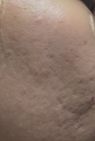 UVイデア XL プロテクショントーンアップ ローズ+/ラ ロッシュ ポゼ/日焼け止め・UVケアを使ったクチコミ（3枚目）