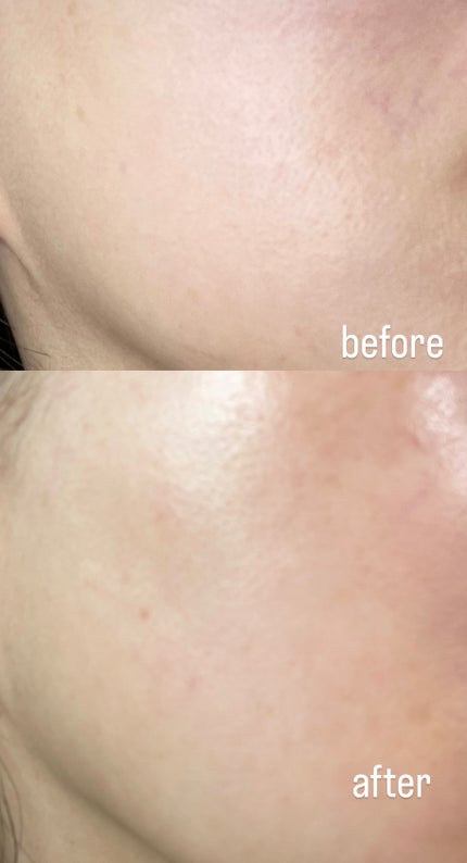 グルタチオンショットB3シミ跡セラム/It's skin/美容液を使ったクチコミ(3枚目)