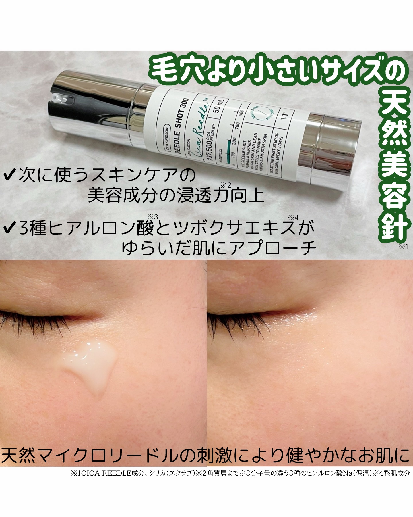 リードルショット300/VT/美容液を使ったクチコミ（2枚目）